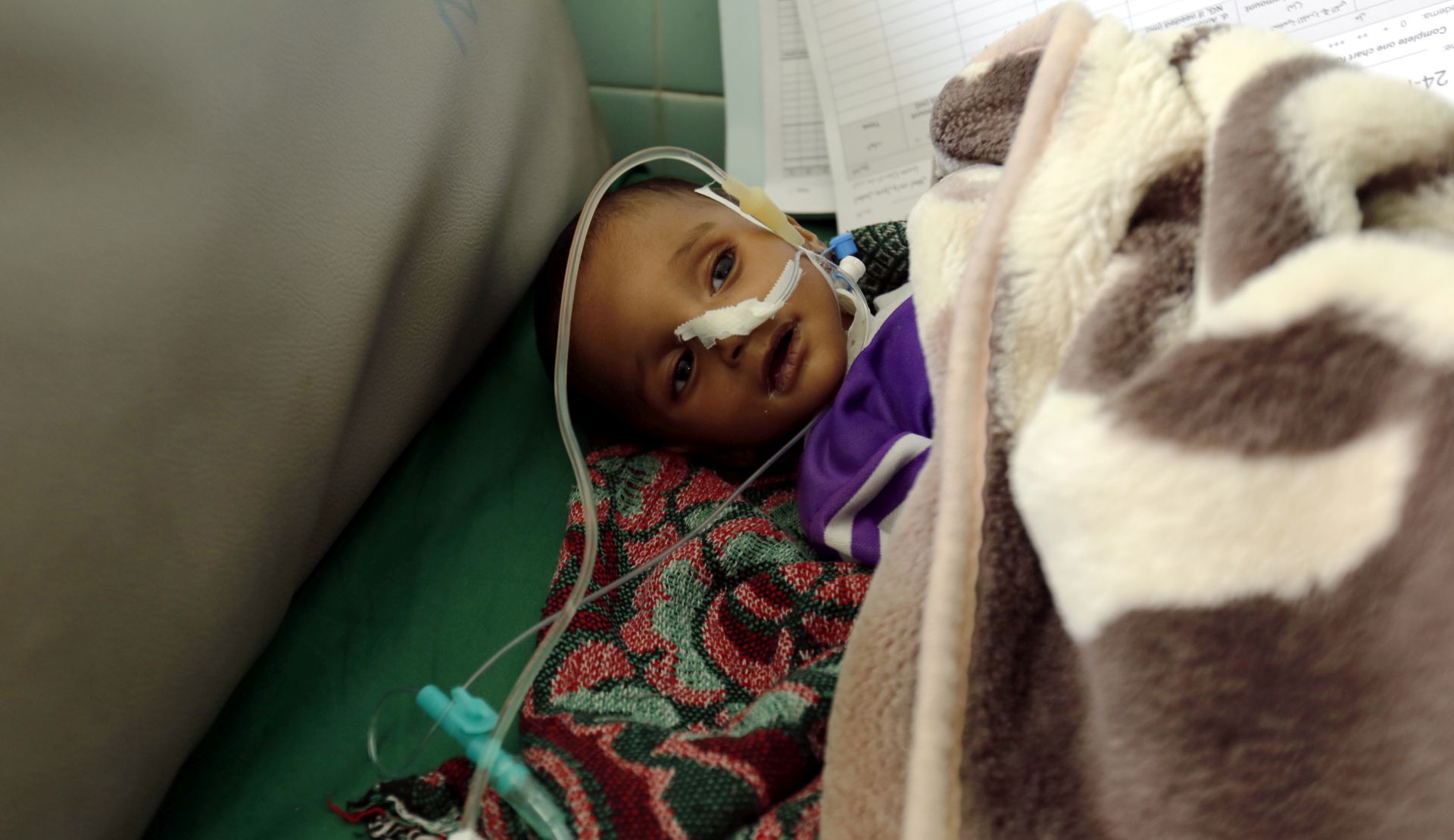 epa07134670 Malnourished child Tareq Ahmed Ali, three months, lies on a bed as he receives treatment at the emergency unit of the malnutrition treatment center, in Sana'a, Yemen, 22 October 2018 (issued 01 November 2018). According to the United Nations Children’s Fund UNICEF, over 11 million children – 80 per cent of all children in the country – require humanitarian assistance, nearly 400,000 severe acutely malnourished children fight for their lives and an additional 1.8 to 2.8 million children are in acute food insecurity as the ongoing conflict causes food and fuel prices to soar across in the war-torn and impoverished Arab country.  EPA/YAHYA ARHAB