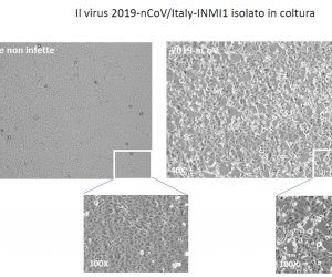epa08187755 An undated handout photo made available by the Lazzaro Spallanzani National Institute for Infectious Diseases (INMI) shows an image of the virus '2019-nCoV/Italy-INMI1' (Viral isolation on cells Vero E6) in Rome, Italy 02 February 2020. 'We have isolated the coronavirus' said the Italian Minister of Health Roberto Speranza during a press conference at the Spallanzani hospital in Rome, Italy, on 02 February 2020. 'Having isolated the virus means many opportunities to study, understand and better verify what you can do it to block the spread. It will be made available to the whole international community. Now it will be easier to treat it.'  EPA/INMI SPALLANZANI HOSPITAL PRESS OFFICE HANDOUT -- BEST QUALITY AVAILABLE -- HANDOUT EDITORIAL USE ONLY/NO SALES