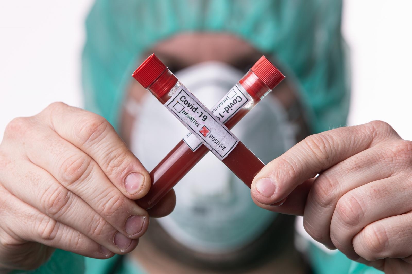 11.03.2020., Zagreb - Ilustracija epruvete s uzorcima krvi - testiranje na koronavirus.
Photo: Davor Puklavec/PIXSELL