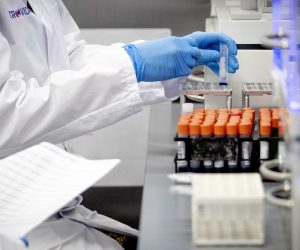 epa08335045 A staff member wearing protective gloves works in the Microvida medical laboratory, at Bravis hospital in Roosendaal, The Netherlands, 31 March 2020. The laboratory conducts tests for the novel coronavirus diseases (COVID-19).  EPA/SEM VAN DER WAL