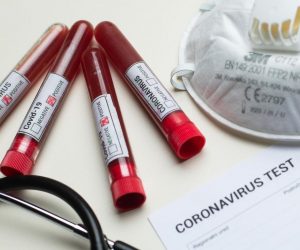11.03.2020., Zagreb - Ilustracija epruvete s uzorcima krvi - testiranje na koronavirus.
Photo: Davor Puklavec/PIXSELL