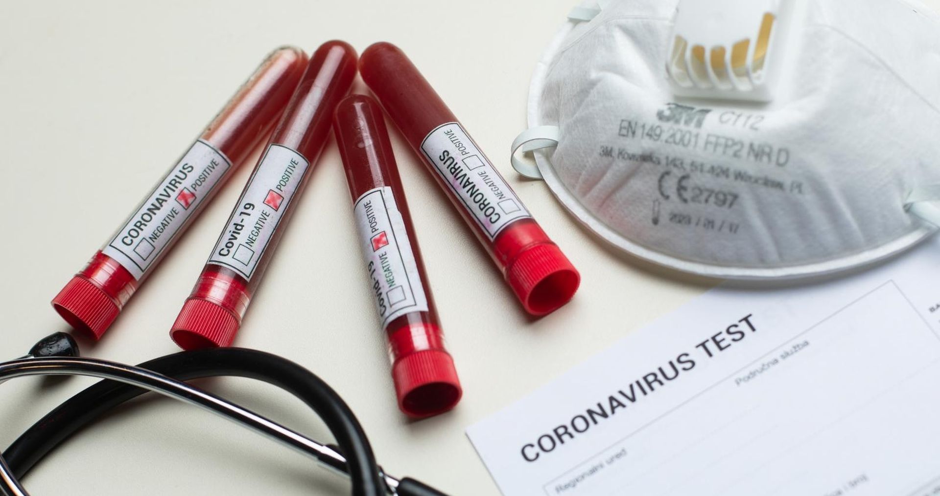11.03.2020., Zagreb - Ilustracija epruvete s uzorcima krvi - testiranje na koronavirus.
Photo: Davor Puklavec/PIXSELL