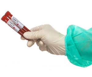 11.03.2020., Zagreb - Ilustracija epruvete s uzorcima krvi - testiranje na koronavirus.
Photo: Davor Puklavec/PIXSELL