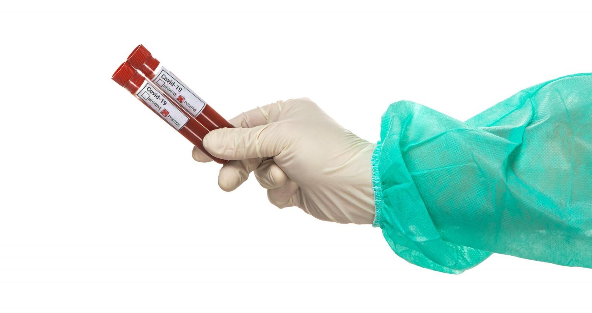 11.03.2020., Zagreb - Ilustracija epruvete s uzorcima krvi - testiranje na koronavirus.
Photo: Davor Puklavec/PIXSELL