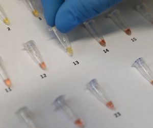 epa08730816 View of the extraction of the genetic code or ribonucleic acid (RNA) of the coronavirus, the same that is amplified to continue with the processing and achieve the result by means of a color reaction, positive yellow, negative red, in the laboratory of Hipolito Unanue Hospital, in Lima, Peru, 08 October 2020. The hospital is the second in Peru to launch the use of rapid molecular tests, a new technology that saves time to detect the presence of the virus in a similar way to PCR. These molecular tests, the results of which are ready in about 45 minutes, use the RT-LAMP technique (loop-mediated isothermal amplification), a method that is usually applied in Peru for the diagnosis of dengue, Zika and tuberculosis.  EPA/Paolo Aguilar
