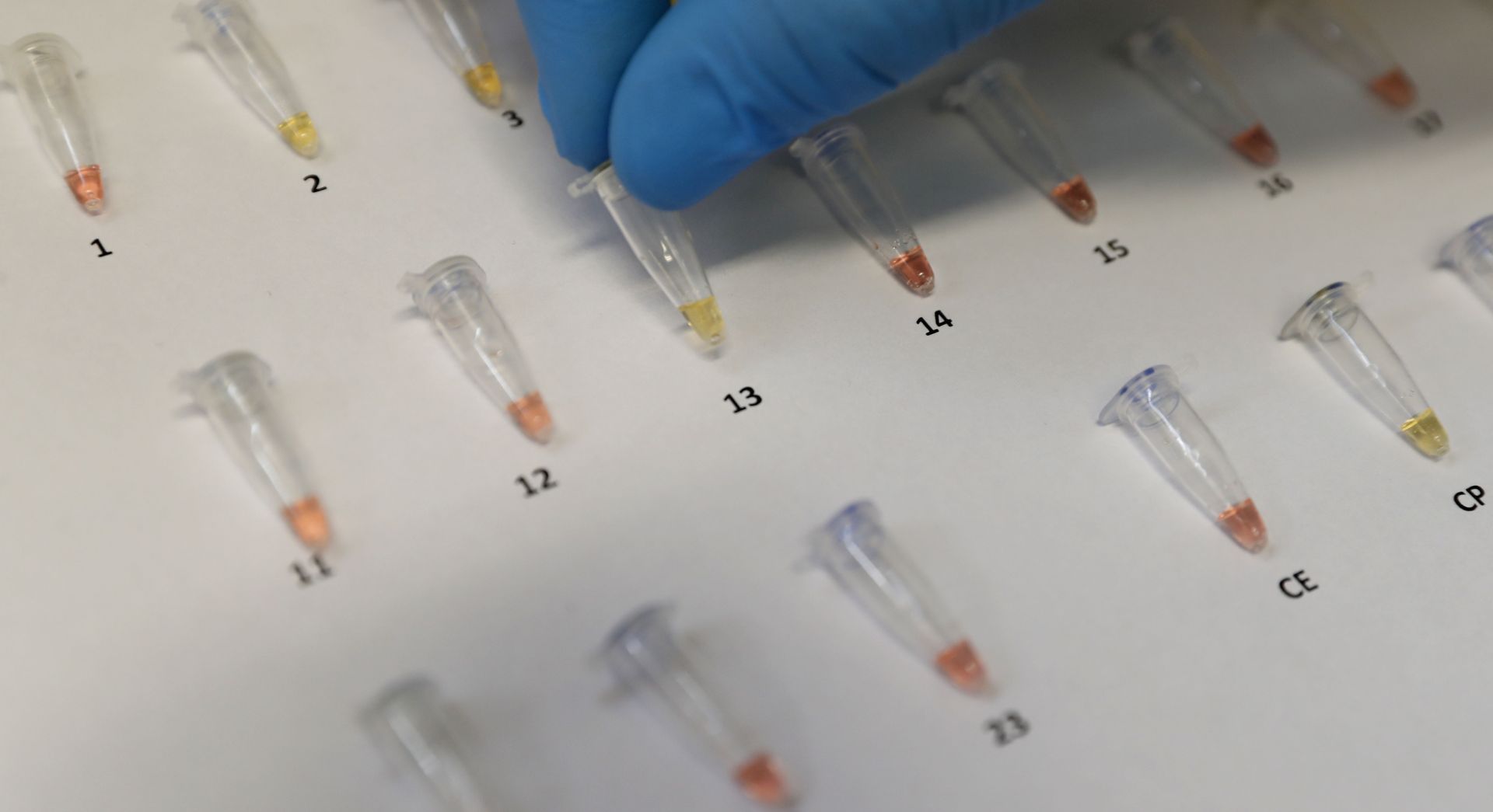 epa08730816 View of the extraction of the genetic code or ribonucleic acid (RNA) of the coronavirus, the same that is amplified to continue with the processing and achieve the result by means of a color reaction, positive yellow, negative red, in the laboratory of Hipolito Unanue Hospital, in Lima, Peru, 08 October 2020. The hospital is the second in Peru to launch the use of rapid molecular tests, a new technology that saves time to detect the presence of the virus in a similar way to PCR. These molecular tests, the results of which are ready in about 45 minutes, use the RT-LAMP technique (loop-mediated isothermal amplification), a method that is usually applied in Peru for the diagnosis of dengue, Zika and tuberculosis.  EPA/Paolo Aguilar