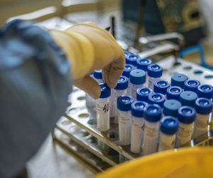 epa08743377 A laboratory technician works on COVID-19 samples at Institute of medical biochemistry and laboratory diagnostics in General University Hospital in Prague, Czech Republic, 14 October 2020. Czech Republic had record rise in the COVID-19 disease, increase in newly detected infections exceeded 8,000 again.  EPA/MARTIN DIVISEK