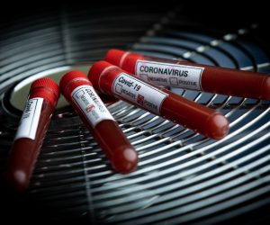 11.03.2020., Zagreb - Ilustracija epruvete s uzorcima krvi - testiranje na koronavirus.
Photo: Davor Puklavec/PIXSELL