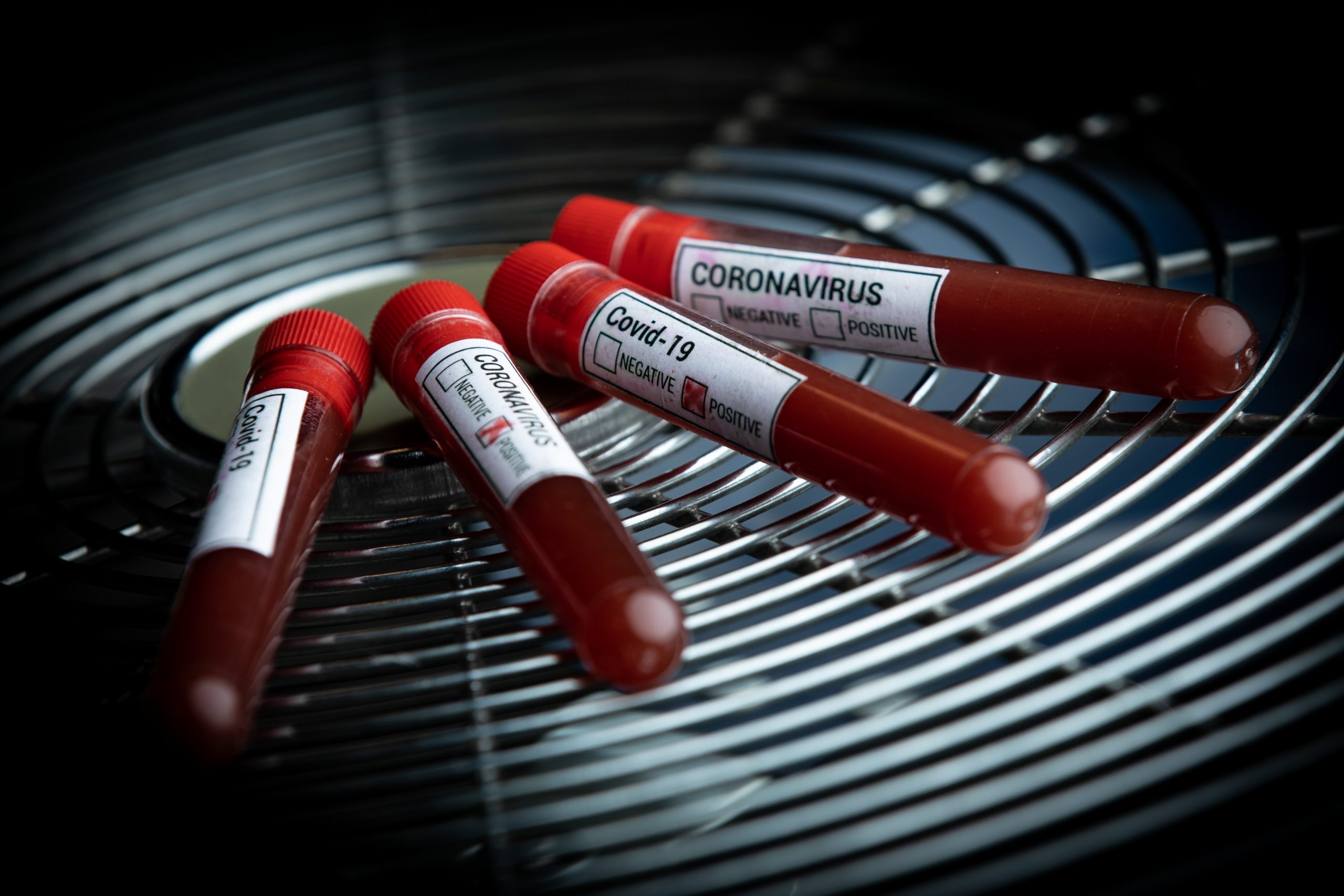 11.03.2020., Zagreb - Ilustracija epruvete s uzorcima krvi - testiranje na koronavirus.
Photo: Davor Puklavec/PIXSELL