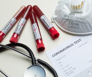 11.03.2020., Zagreb - Ilustracija epruvete s uzorcima krvi - testiranje na koronavirus.
Photo: Davor Puklavec/PIXSELL