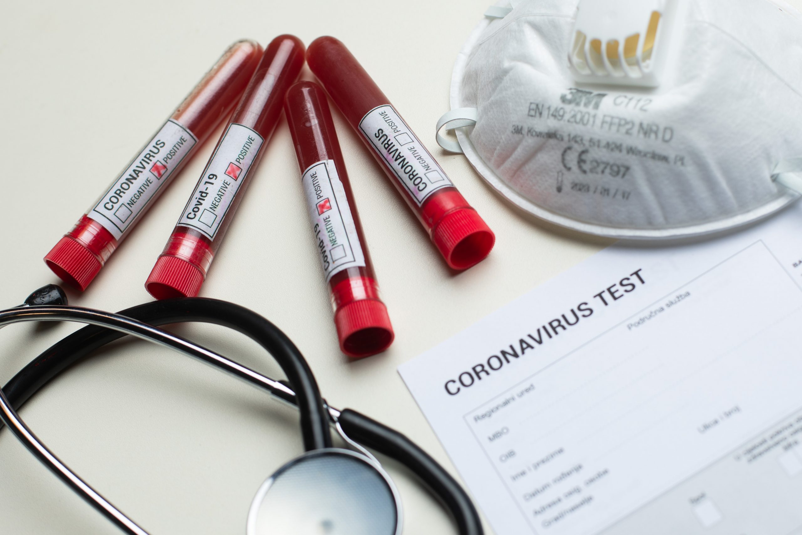 11.03.2020., Zagreb - Ilustracija epruvete s uzorcima krvi - testiranje na koronavirus.
Photo: Davor Puklavec/PIXSELL