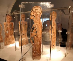 06.04.2010., Zagreb - Galerija Klovicevi dvori, glasovita edukativna svjetska izlozba Bodies Revealed stigla je u Zagreb.Svecano otvorenje izlozbe je 09.travnja 2010. 
Photo: Robert Anic/PIXSELL