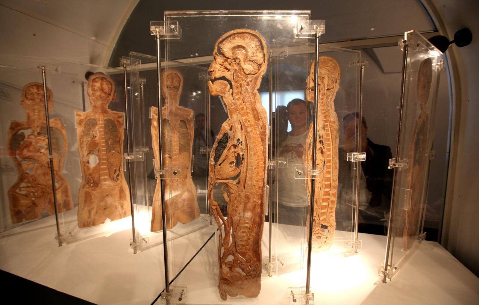 06.04.2010., Zagreb - Galerija Klovicevi dvori, glasovita edukativna svjetska izlozba Bodies Revealed stigla je u Zagreb.Svecano otvorenje izlozbe je 09.travnja 2010. 
Photo: Robert Anic/PIXSELL