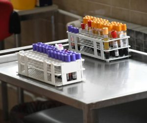 16.10.2020., Cazma -  Cazmanski Dom zdravlja dodatno je opremljen medicinsko-biokemijskim laboratorijem s novom modernom dijagnostickom opremom u vidu novog biokemijskog uredjaja, hematoloskog uredjaja, uredjaja za proizvodnju ciste vode, nadogradnju informatickog sustava, te  nova racunala. Oprema u novom laboratoriju vrijedna je 730.000 kuna.
Photo:Damir Spehar/PIXSELL