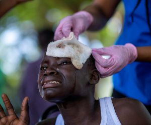 Aftermath of a 7.2 magnitude quake in Les Cayes. A boy injured after Saturday's 7.2 magnitude quake cries while being treated at the Ofatma Hospital, in Les Cayes, Haiti August 18, 2021. REUTERS/Ricardo Arduengo     TPX IMAGES OF THE DAY RICARDO ARDUENGO