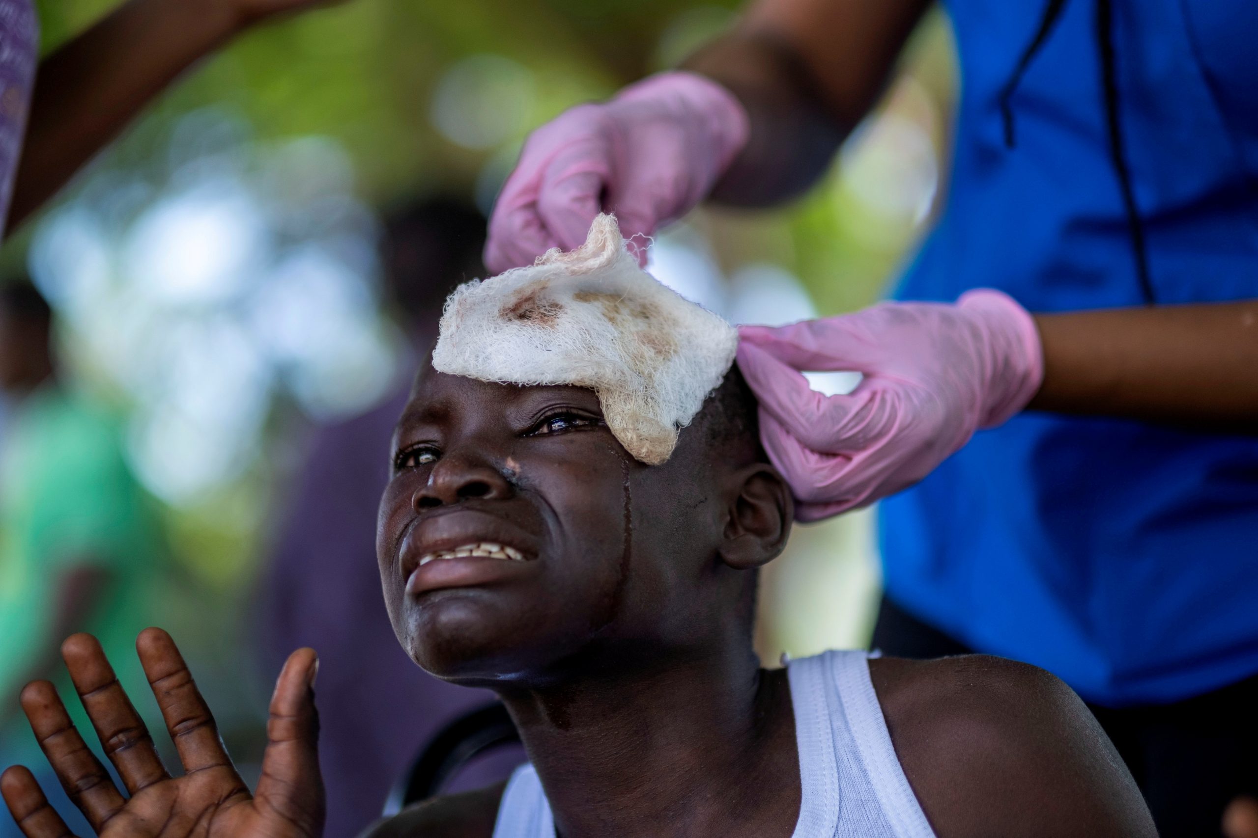 Aftermath of a 7.2 magnitude quake in Les Cayes. A boy injured after Saturday's 7.2 magnitude quake cries while being treated at the Ofatma Hospital, in Les Cayes, Haiti August 18, 2021. REUTERS/Ricardo Arduengo     TPX IMAGES OF THE DAY RICARDO ARDUENGO