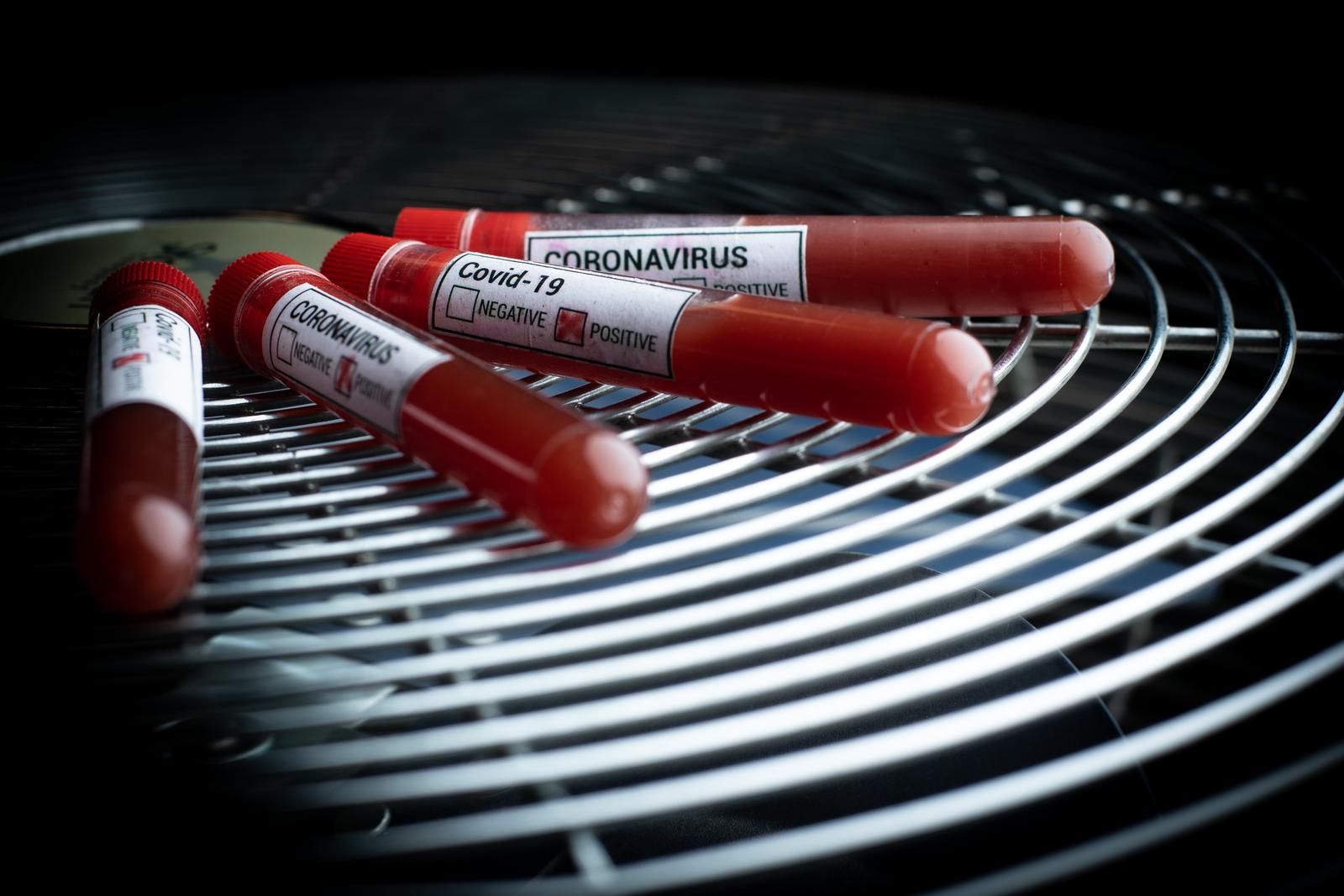11.03.2020., Zagreb - Ilustracija epruvete s uzorcima krvi - testiranje na koronavirus.
Photo: Davor Puklavec/PIXSELL