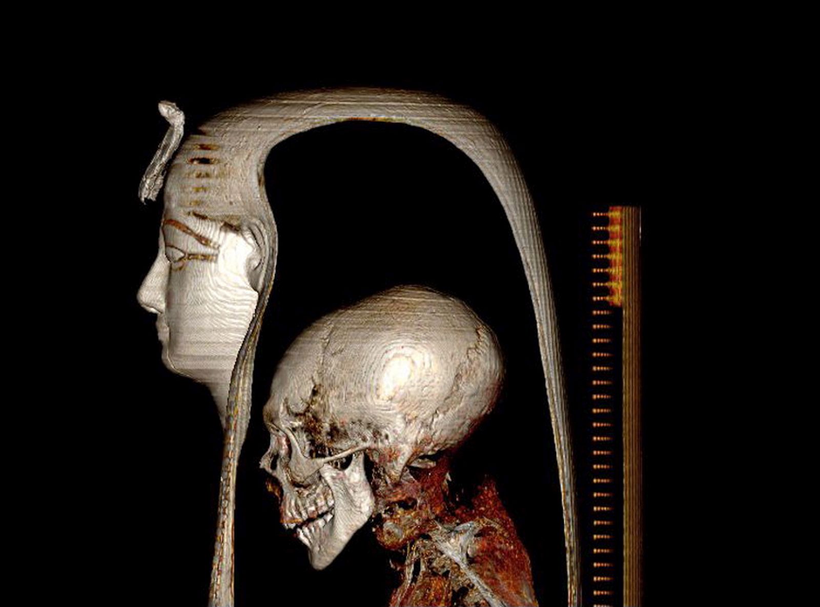 epa09658622 A handout photo made available by the Egyptian Ministry of Antiquities on 28 December 2021 shows an image of the head of King Amenhotep I created using computed tomography (CT) scanning, in Cairo, Egypt. A scientific study published on 28 December in Frontiers in Medicine scientific journal used computed tomography (CT) scanning and advanced computer software programs in a safe non-invasive method without the need to touch the mummy to reveal for the first time the face of King Amenhotep I behind the funerary mask, his age, health condition, in addition to many secrets about the mummy's unique mummification and reburial.  EPA/EGYPTIAN MINISTRY OF ANTIQUITIES HANDOUT  HANDOUT EDITORIAL USE ONLY/NO SALES
