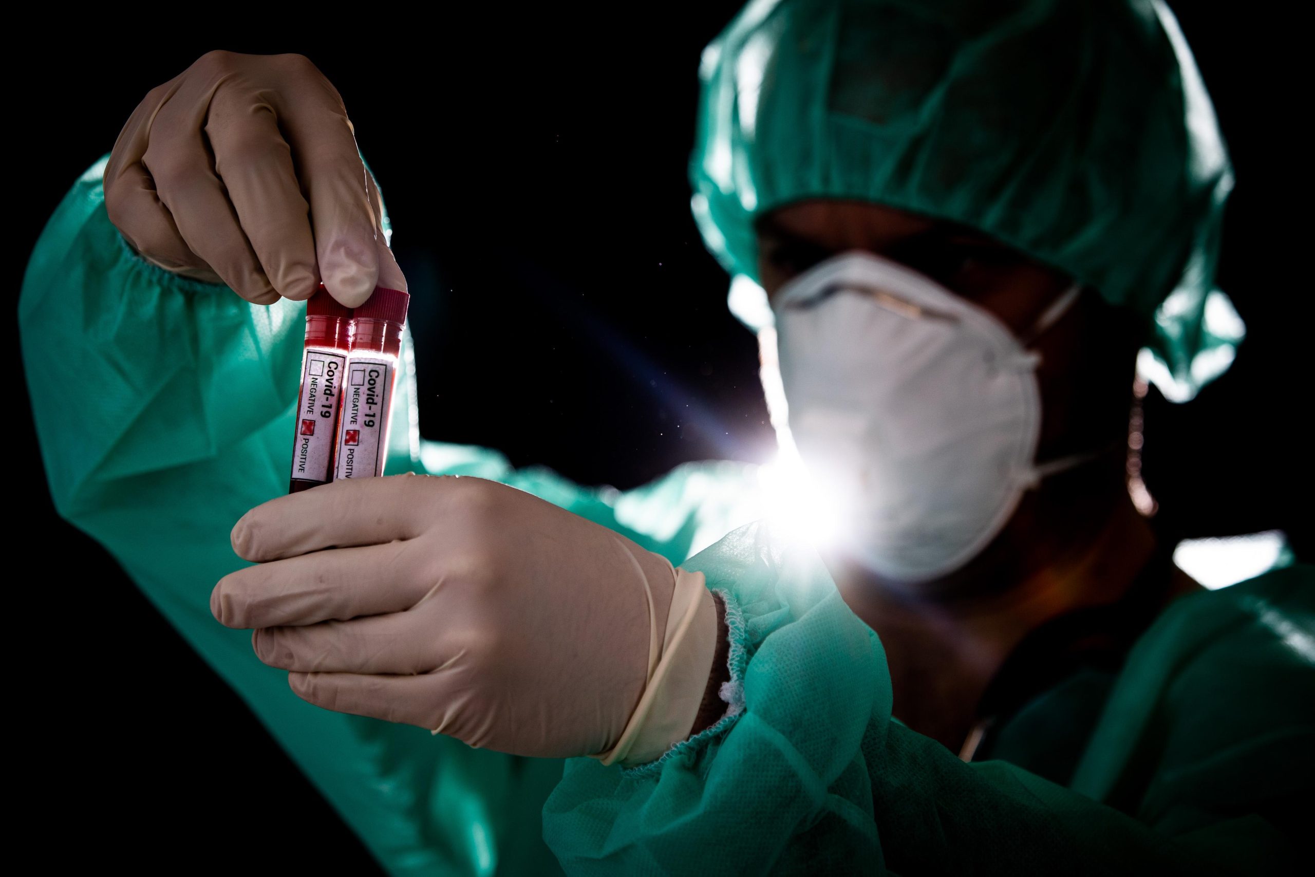 11.03.2020., Zagreb - Ilustracija epruvete s uzorcima krvi - testiranje na koronavirus.
Photo: Davor Puklavec/PIXSELL