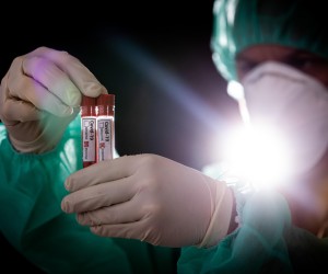 11.03.2020., Zagreb - Ilustracija epruvete s uzorcima krvi - testiranje na koronavirus.r"nPhoto: Davor Puklavec/PIXSELL