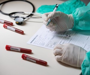 11.03.2020., Zagreb - Ilustracija epruvete s uzorcima krvi - testiranje na koronavirus.rPhoto: Davor Puklavec/PIXSELL