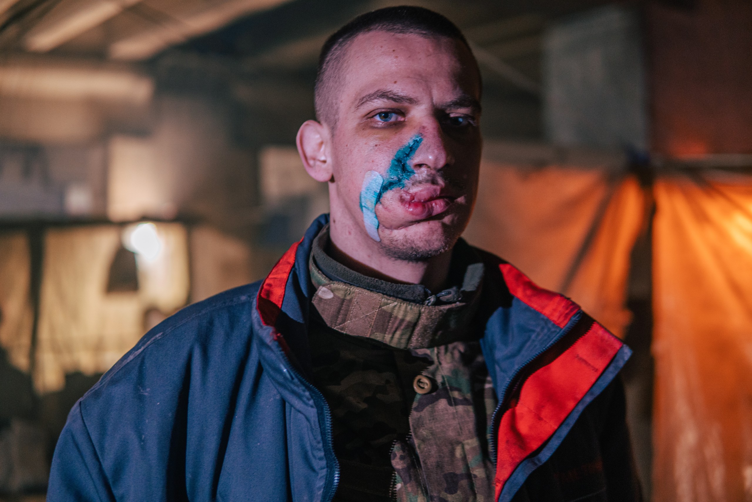 epa09940289 A handout picture made available by Regiment Azov press service shows an injured Ukrainian serviceman in a shelter at the Azovstal Iron and Steel Plant in Mariupol, Ukraine, 10 May 2022 (issued 11 May 2022). The Regiment Azov via their Telegram channel on 10 May 2022 have described the situation of their servicemen as "complete unsanitary conditions, with open wounds bandaged with non-sterile remnants of bandages, without the necessary medication and even food" and demanded evacuation to Ukrainian-controlled territory. On 24 February, Russian troops entered Ukrainian territory starting a conflict that has provoked destruction and a humanitarian crisis. According to data released by the UNHCR on 10 May, close to six million Ukrainians have fled their country since 24 February 2022.  EPA/Dmytro 'Orest' Kozatskyi/Azov Special Forces Regiment / HANDOUT  HANDOUT EDITORIAL USE ONLY/NO SALES