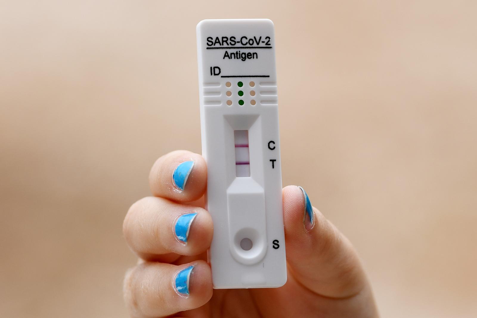 29.07.2022., Sibenik - U posljednjih nekolko dana u Republici Hrvatskoj povecan je broj zarazenih koronavirusom. Pozitivan test na koronavirus. Photo: Hrvoje Jelavic/PIXSELL