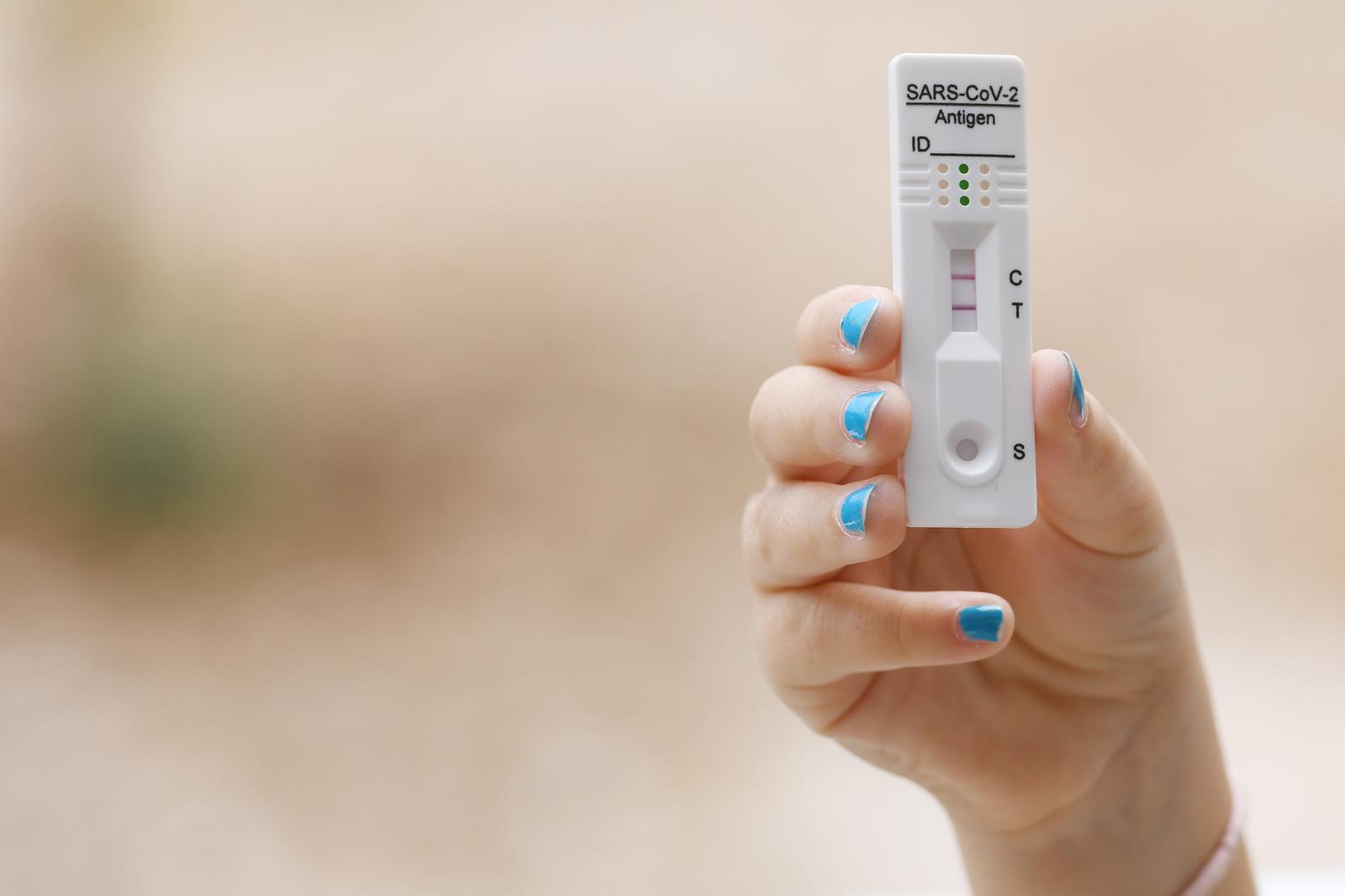 29.07.2022., Sibenik - U posljednjih nekolko dana u Republici Hrvatskoj povecan je broj zarazenih koronavirusom. Pozitivan test na koronavirus. Photo: Hrvoje Jelavic/PIXSELL