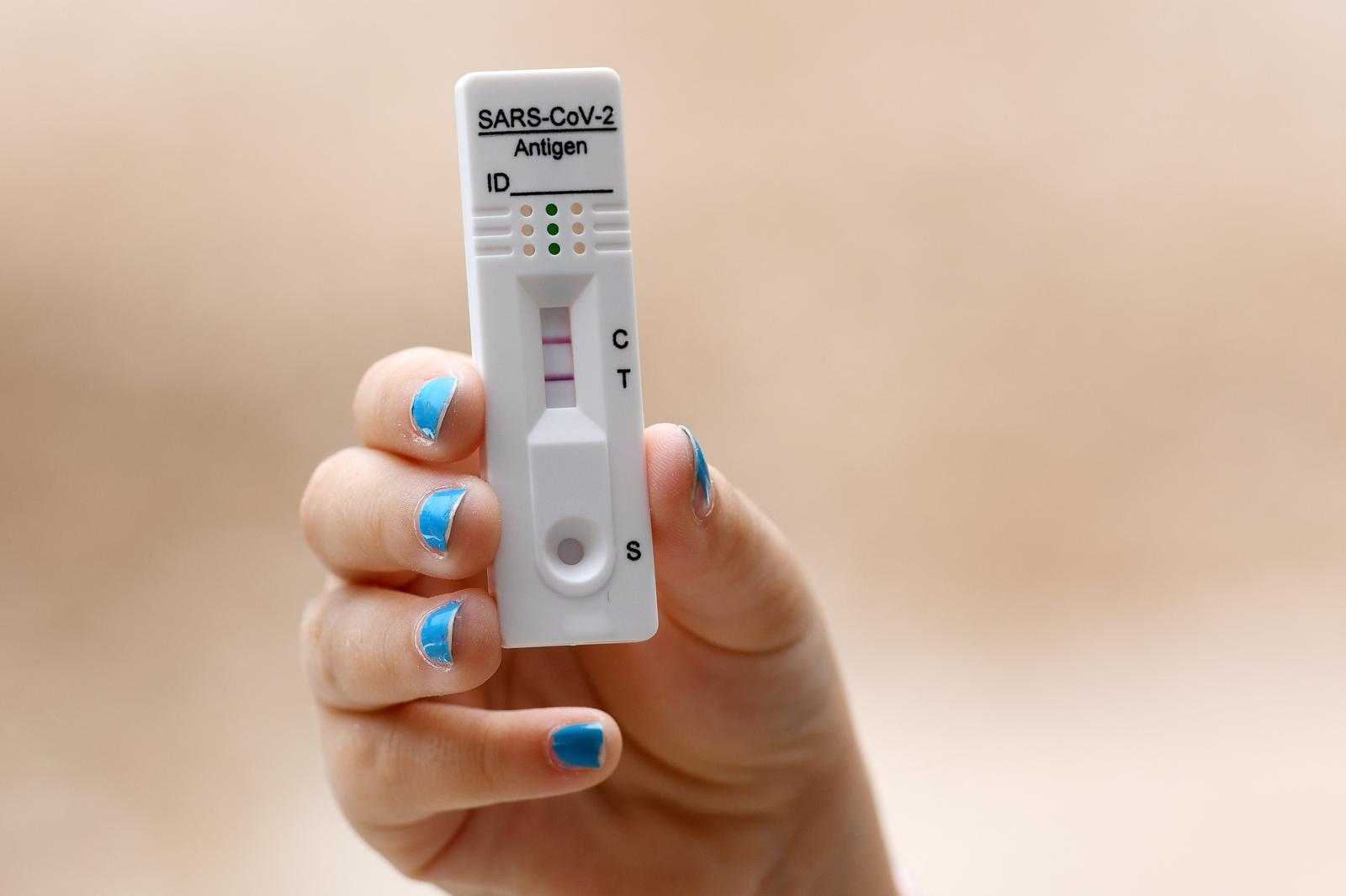 29.07.2022., Sibenik - U posljednjih nekolko dana u Republici Hrvatskoj povecan je broj zarazenih koronavirusom. Pozitivan test na koronavirus. Photo: Hrvoje Jelavic/PIXSELL