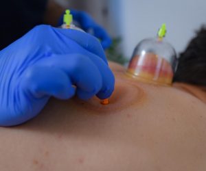 14.06.2022.., Zagreb - Cupping centar. Doktor Mehran Shafie   Photo: Josip Regovic/PIXSELL