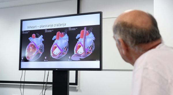 21.07.2023., Zagreb - Na KBC-u Zagreb odrzana je konferencija za medije povodom revolucionarlnog lijecenja po zivot ugrozavajuce aritmije srca s pomocu tzv. radioablacije. Photo: Zeljko Lukunic/PIXSELL