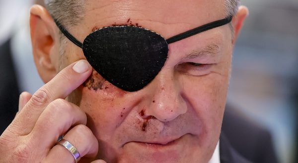 epa10841871 German Chancellor Olaf Scholz touches his bruises as he attends the opening walk at the International Motor Show (IAA) in Munich, Germany, 05 September 2023. The 2023 International Motor Show Germany IAA MOBILITY 2023 takes place in Munich from 05 to 10 September 2023. The IAA 2023 will feature numerous world premieres and has a special focus on electric mobility and digitization. Scholz is wearing an eye patch after suffering facial injuries in a sports accident.  EPA/RONALD WITTEK