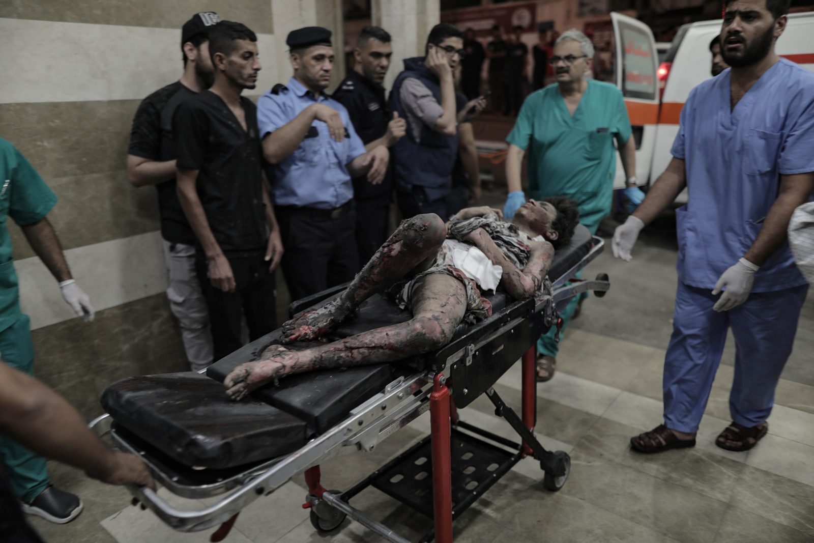 epa10935360 A Palestinian man injured in an Israeli strike is rushed into Nasser Hospital in Khan Younis, southern Gaza Strip, early 24 October 2023. More than 5,000 Palestinians and over 1,400 Israelis have been killed, according to the Israel Defense Forces (IDF) and the Palestinian health authority, since Hamas militants launched an attack against Israel from the Gaza Strip on 07 October.  EPA/HAITHAM IMAD   ATTENTION EDITORS: GRAPHIC CONTENT