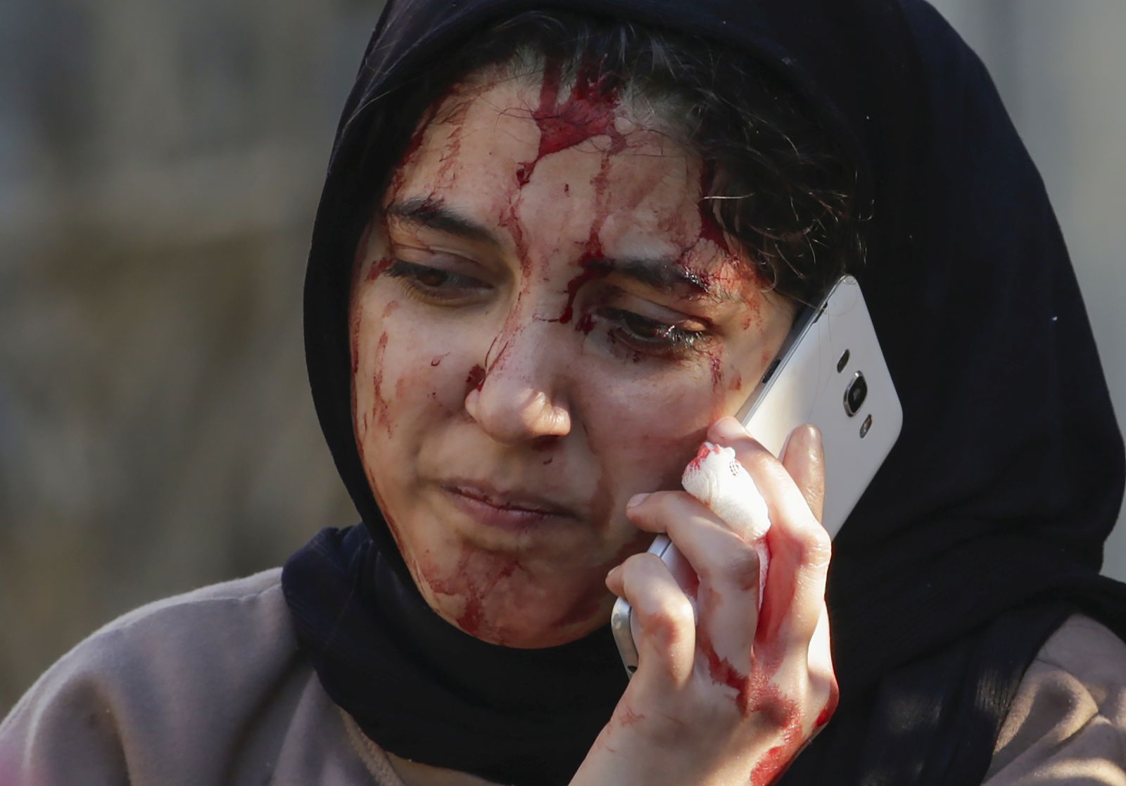 epa11059815 An injured Palestinian woman seen following an Israeli air strike in Deir Al Balah town during Israeli military operations in the southern Gaza Strip on, 05 January 2024. More than 22,300 Palestinians and at least 1,300 Israelis have been killed, according to the Palestinian Health Ministry and the Israel Defense Forces (IDF), since Hamas militants launched an attack against Israel from the Gaza Strip on 07 October, and the Israeli operations in Gaza and the West Bank which followed it. Since 07 October, up to 1.9 million people, or more than 85 percent of the population, have been displaced throughout the Gaza Strip, some more than once, according to the United Nations Relief and Works Agency for Palestine Refugees in the Near East (UNRWA), which added that most civilians in Gaza are in 'desperate need of humanitarian assistance and protection'.  EPA/MOHAMMED SABER
