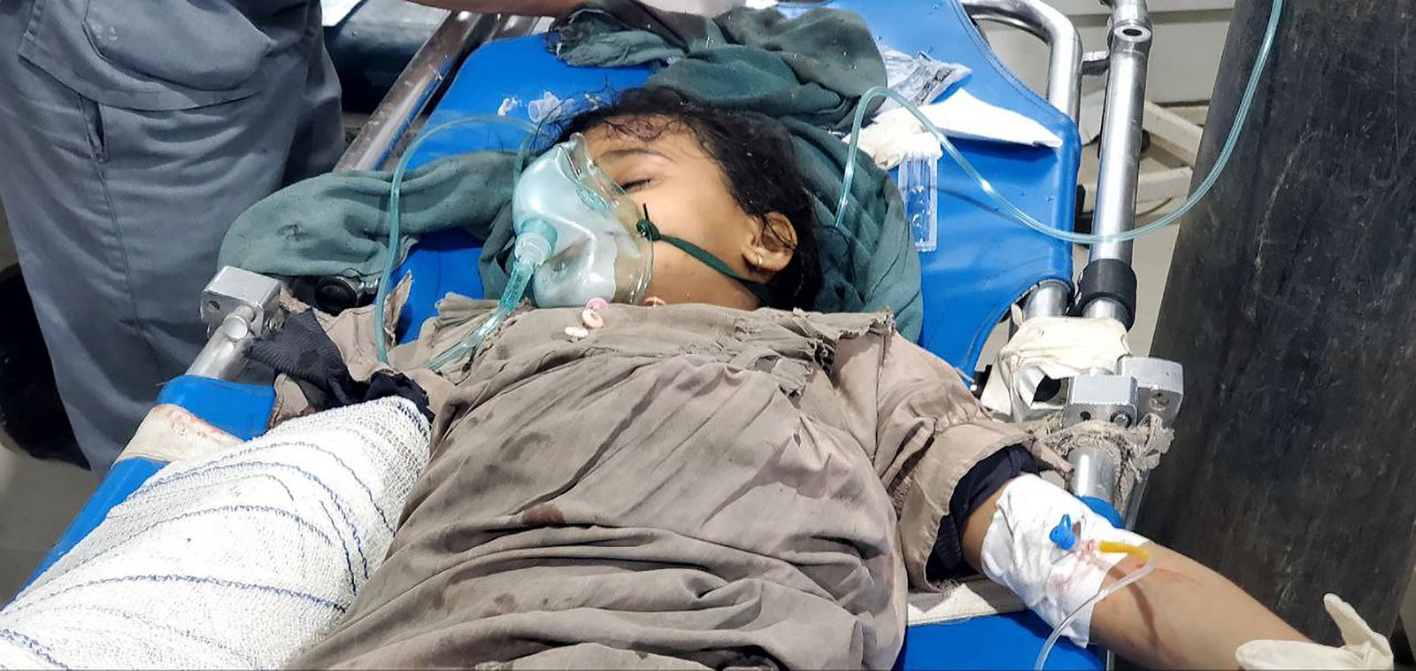 Medics attend to a girl injured by a U.S. strike in Saada, Yemen, on Sunday on March 16, 2025. U.S. strikes in , Yemen killed more than 30 people. Photo by Houthi Group press Service/ UPI Photo via Newscom Photo: Houthi Group press Service/NEWSCOM