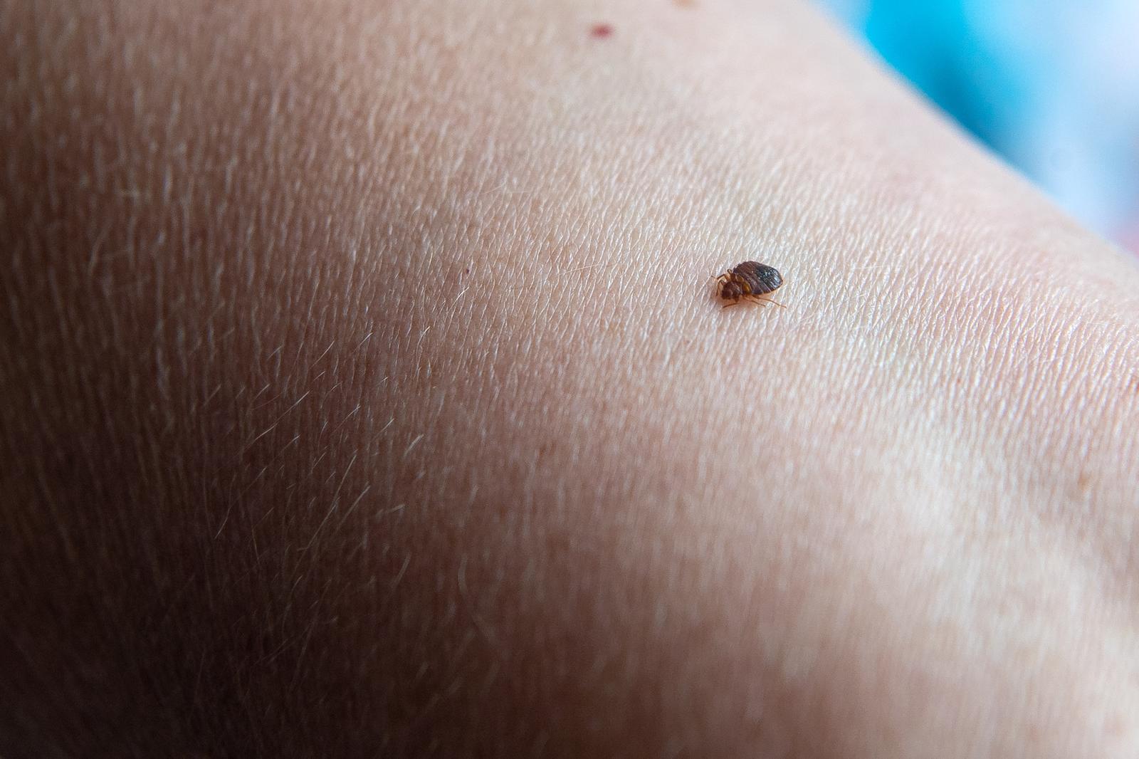 PRODUCTION - 23 June 2021, Lower Saxony, Delmenhorst: A bedbug bites an arm.  Bed bugs are not at all uncommon. The bloodsuckers are nocturnal and masters at hiding, but bed bug sniffing dogs detect the insects. Photo: Sina Schuldt/dpa /DPA/PIXSELL