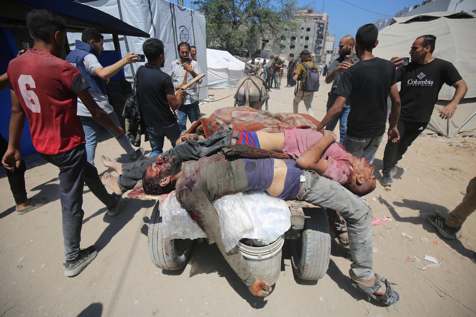 Injured and bodies were brought to Al-Shifa Hospital in Gaza City after Israeli forces opened fire on civilians who were waiting for humanitarian aid Injured and bodies were brought to Al-Shifa Hospital in Gaza City after Israeli forces opened fire on civilians who were waiting for humanitarian aid near the Zikim area on the northern Gaza coastline, Gaza City, on July 20, 2025. Photo by Omar Ashtawy apaimages Gaza city Gaza Strip Palestinian Territory 200725_Gaza_OSH_0025 Copyright: xapaimagesxOmarxAshtawyxxapaimagesx Photo: IMAGO/Omar Ashtawy  apaimages/IMAGOSTOCK&PEOPLE