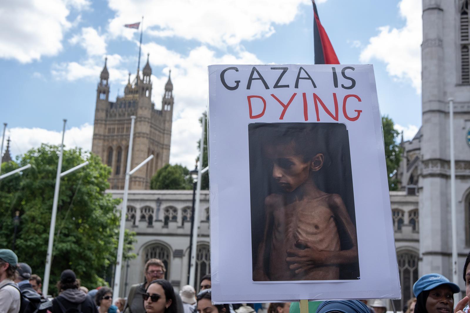 A protester holds a placard with a photo about a starving child in Gaza during the demonstration. Demonstrators gathered on the Parliament Square in London, UK. The protesters aim was to show their support to the Palestine Action and also, to demand from the British government to take the organisation off from the terrorist list. (Photo by Krisztian Elek / SOPA Images/Sipa USA) Photo: SOPA Images/SIPA USA